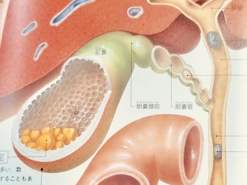 痩せる 胆嚢 摘出 胆嚢除去後の体重減少の管理