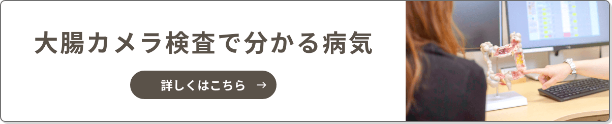 大腸内視鏡検査でわかる疾患