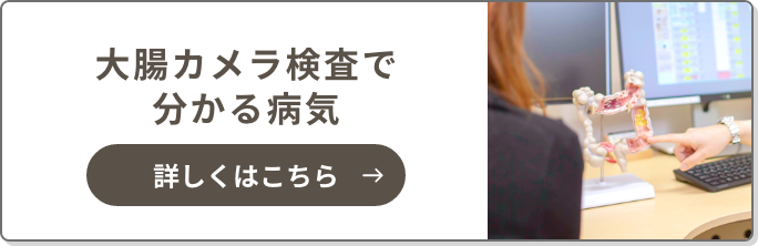 大腸内視鏡検査でわかる疾患