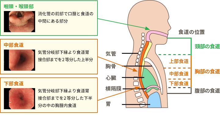 胃と十二指腸のつなぎ目（胃の出口にあたる場所です）