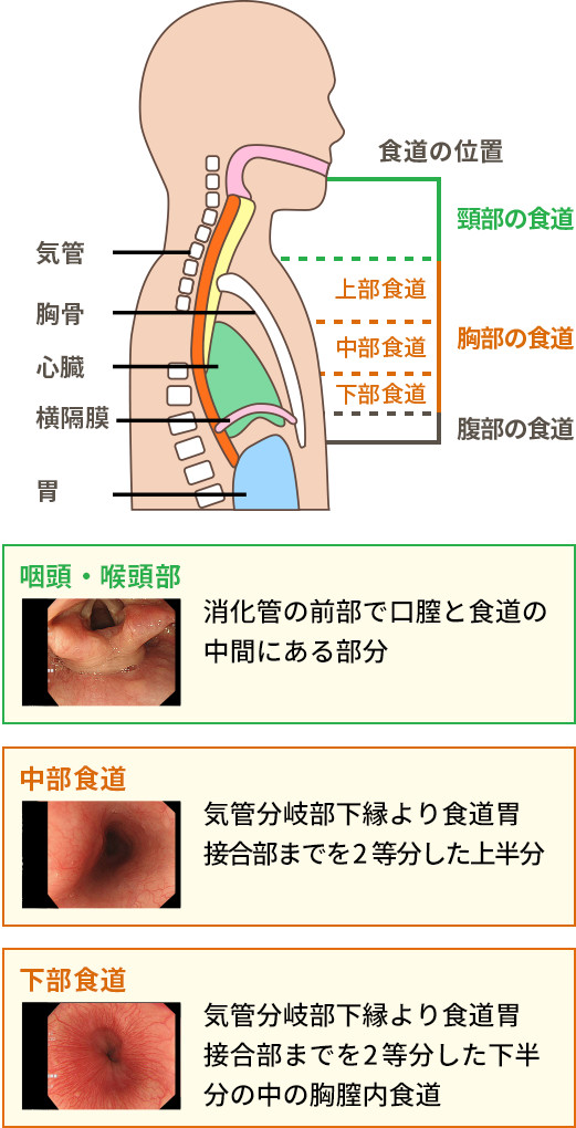 胃と十二指腸のつなぎ目（胃の出口にあたる場所です）