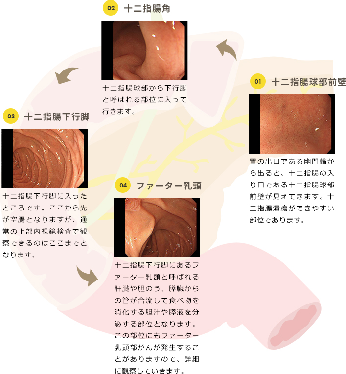 十二指腸の病気