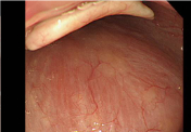口蓋垂の先は咽頭と呼ばれる領域に入ってきます。