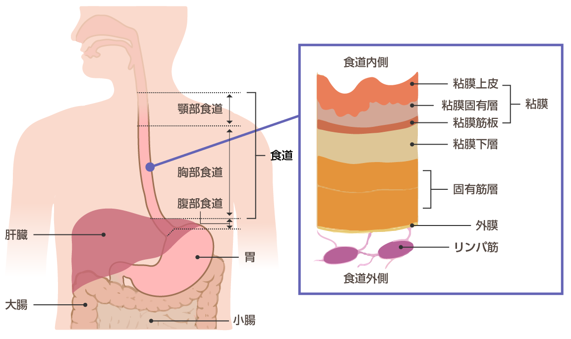 好酸球性食道炎の最も効果的な治療法は何ですか?