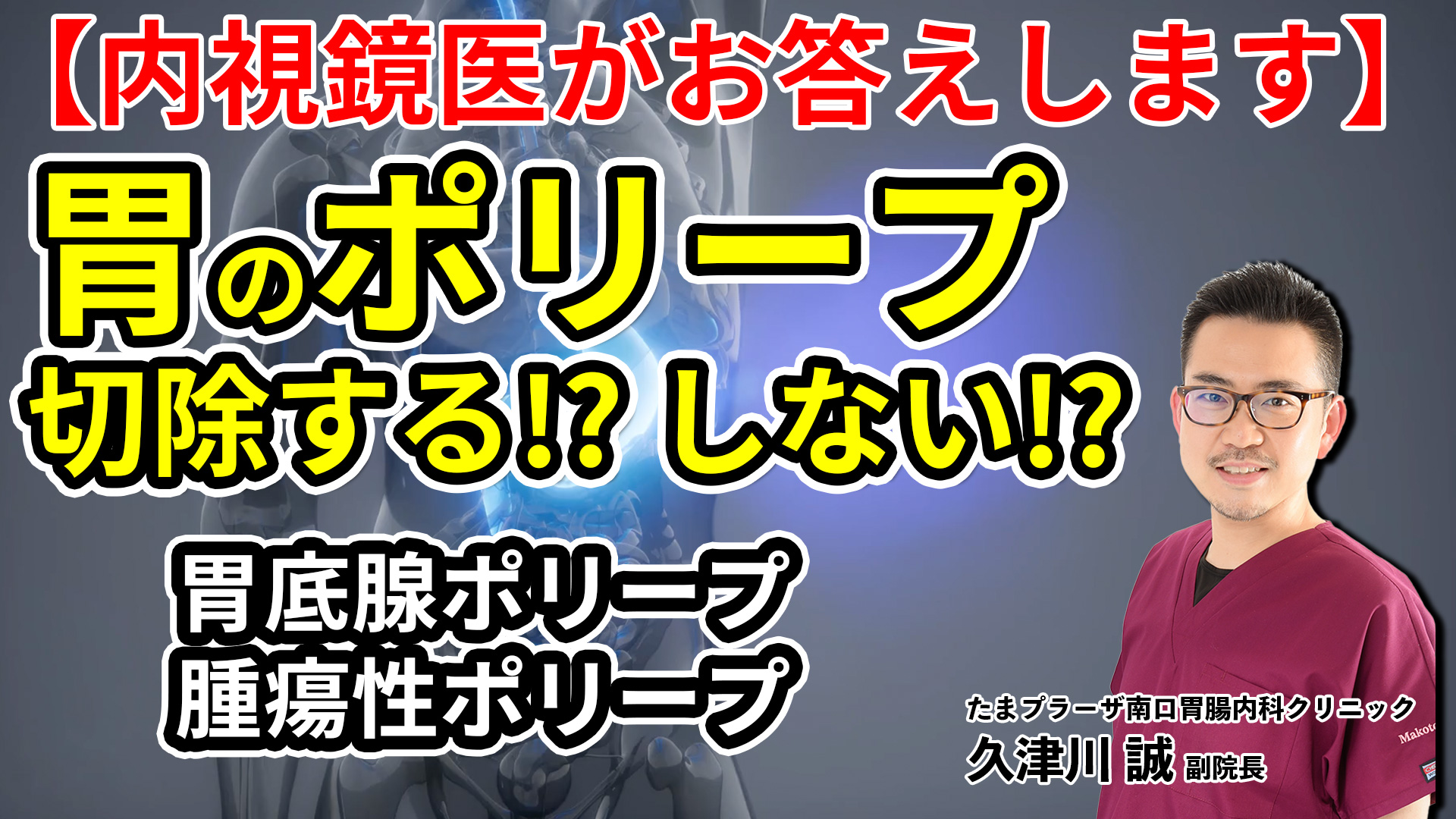 胃ポリープのリスクを下げるにはどうすればよいですか?